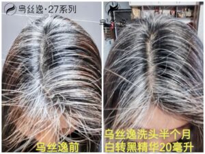 藕片使用乌丝逸半个月后的效果反馈