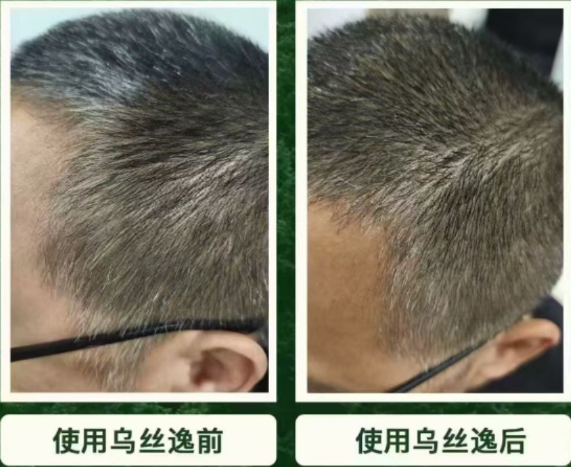 乌丝逸黑发效果